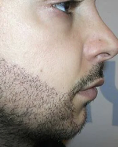 Greffe de Barbe — Premiers jours